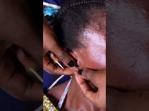 Asmr deep ear nitpicking #tingling #asmrvideos #satisfying #skincare #nitpicking #relaxingtriggers