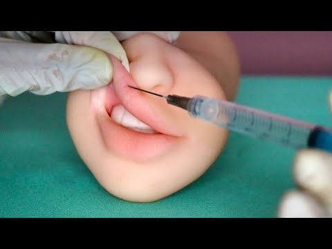 ASMR PREENCHIMENTO LABIAL ( realista) - video satisfatório -