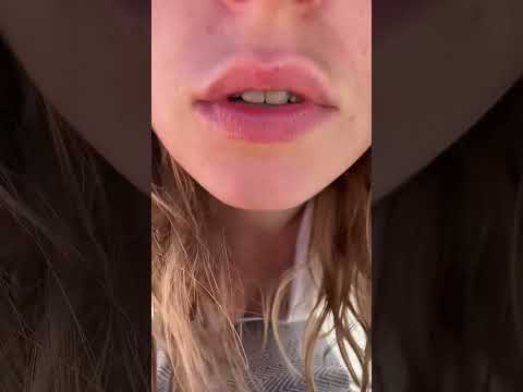 Kiss triggers ✨