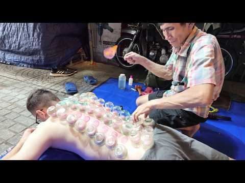 LEGENDARY 5$ Street Massage + My First Cupping Experience! 💆‍♂️🔥🇻🇳