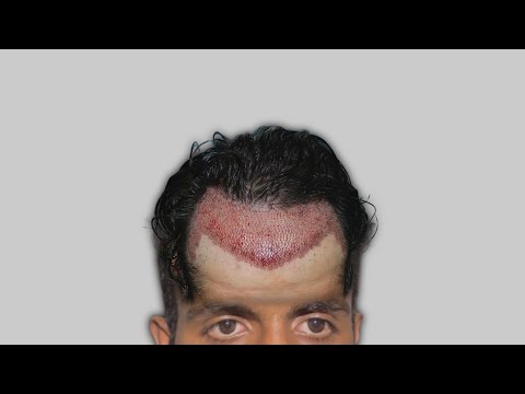 ASMR Hair-Treatment Part 2
