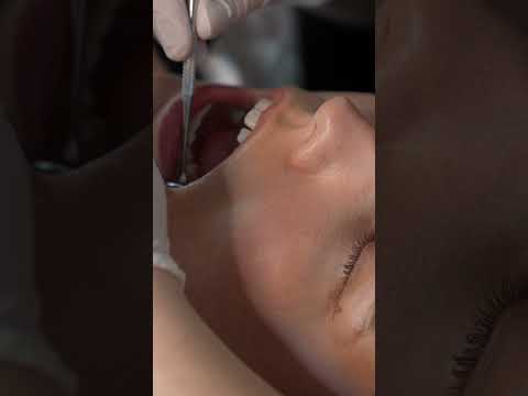 Daily Short(Sorry for Messed up Audio!) Dental Exam  #asmr  #asmrmedical #asmrdentist #asmrteeth