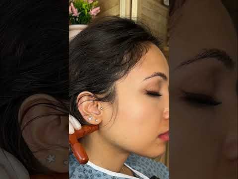 Asmr ear 👂 exam #asmr #relax #relaxing #asmrsounds #asmrvideo #tingles #medical #satisfying #sleep