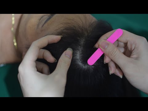 ASMR Real Person Scalp Scratching Aggressive, Scalp Massage No Talking, Relaxing Sounds For You
