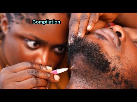 ASMR✨Relaxing Beard Nitpicking & Grooming | Intense Beard Scratching,Head & Ear Massage, COMPILATION