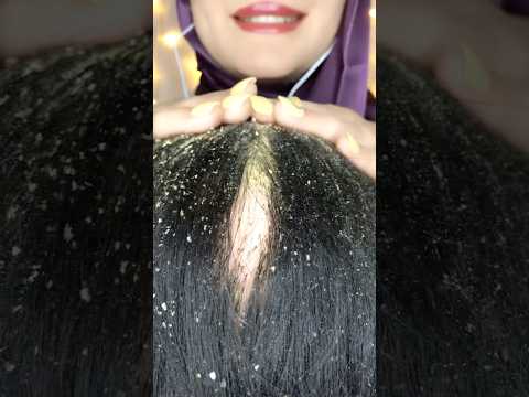 ASMR Dandruff Removal 💆🏻‍♀️🍪 #asmr #asmrhaircare #asmrhairplay #asmrhandmassage #asmrscratching