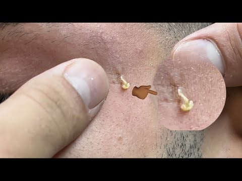 Facial Examination Asmr Real Person