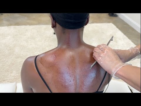 Cleaning & Scraping Out Every Crevice of Her Back *Back Cracks* Help with Pain Relief