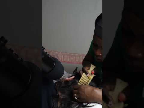 Nitpicking tiny whiteheads to cure his insomnia | FULL VIDEO POSTED #shorts #shortsfeed #hairstyle