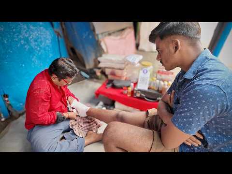INTENSE DEEP Tissue Foot Massage For INSTANT Relaxation | First Aid Treatment | ASMR Gautam