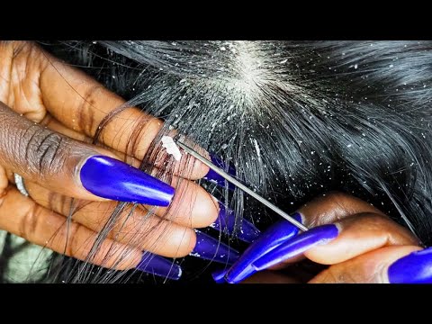 {ASMR} Super Intense 🤯 Scalp Scratching & PICKING | ALLZOOMED | layered sounds