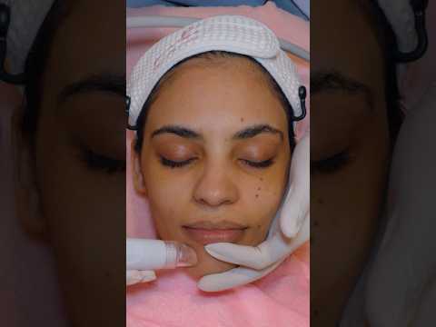 ASMR: Relaxing Hydra Facial Treatment for Brighter Skin! #shorts