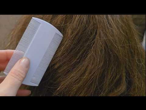 Close Up ASMR Nit Headlice Scalp check RP