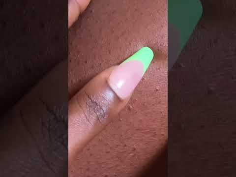 ASMR BEST NITPICKING #asmr