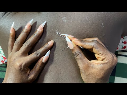 ASMR BACK SCRATCHING AND NIT PICKING FOR DEEP SLEEP/ RELAXING ASMR
