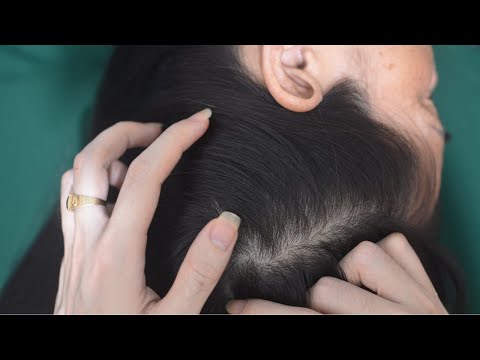 ASMR Nape And Scalp Scratching, Relaxing Hair Sounds - No Talking For Anxiety Relief