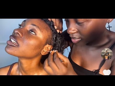 ASMR Deep Ear Cleaning* Ear Flossing, PimplePopping, Head Scratching & Ear Eating nitpicking