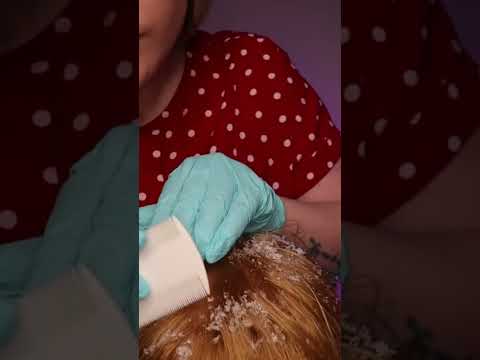 A SATISFYING ASMR Dandruff Removal, Scalp Check & Treatment #asmr #bebravebeyouasmr #asmrscalpcheck