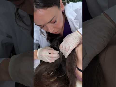 Asmr scalp tingles #asmr #asmrsounds #asmrvideo #relax #relaxing #satisfying #hair #sleep #tingles