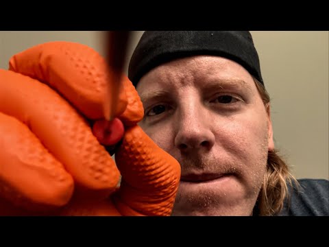 ASMR Face Surgery