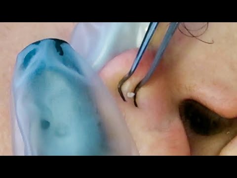 ASMR So Tingly Ear Picking, Cleaning, Massaging