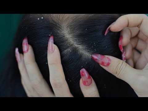 ASMR Scalp Check Real Person With Long Nails Relaxing For Deep Sleep ( No Talking )