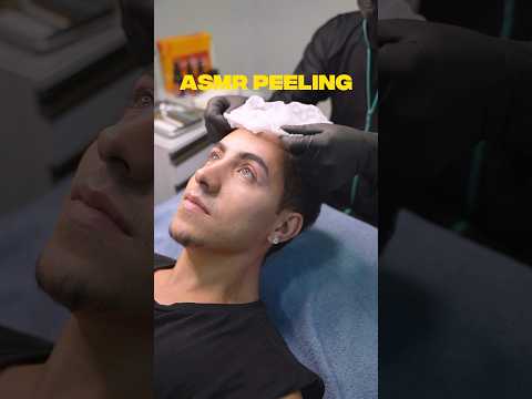 FIZ PEELING FACIAL EM #ASMR