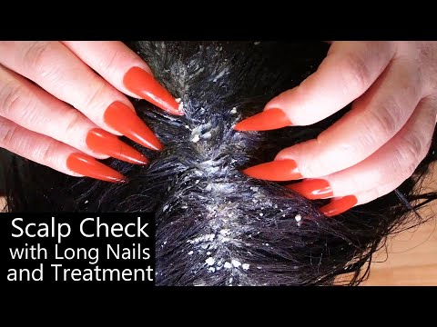 ASMR Scalp Check with Long Nails (Dandruff Removal, Scalp Treatment, Scalp Scratching, Whispering)