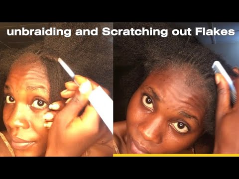 Asmr Unbraiding and Scratching My Dandruff and Flakes part 1 #flakes #asmrsound #asmr #sleep
