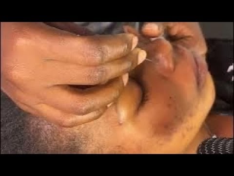 ASMR SCALP SCRATCHING,!EAR SCRATCHING FOR RELAXATION