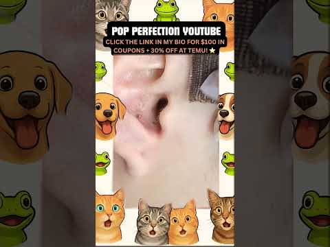 Wow! #pimpleremoval #pimple #pimples #shortsfeed #shortvideo #shorts #short #youtube #youtubeshorts