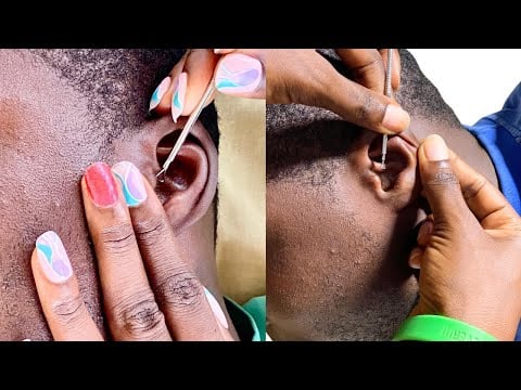 ASMR SUPER ATTENTIVE NITPICKING FOR SLEEP- BUBBLE Gum CRACKING
