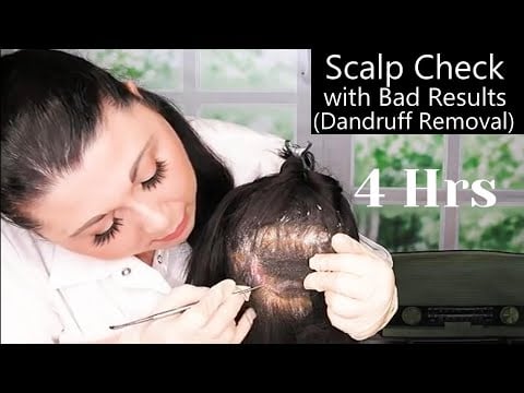 ASMR Scalp Check with Bad Results Compilation (Dandruff Removal, Scalp Treatment) Medical Roleplay