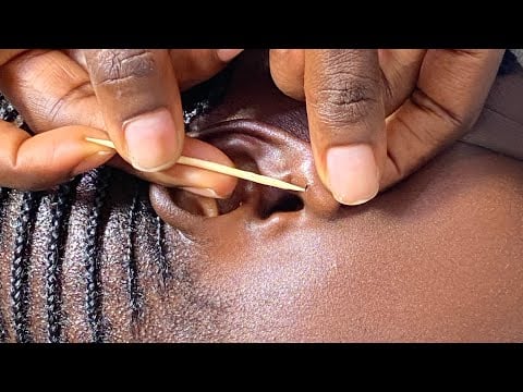 ASMR RELAXING EAR PICKING FOR SATISFYING SLEEP - EAR PIERCING CLEANING