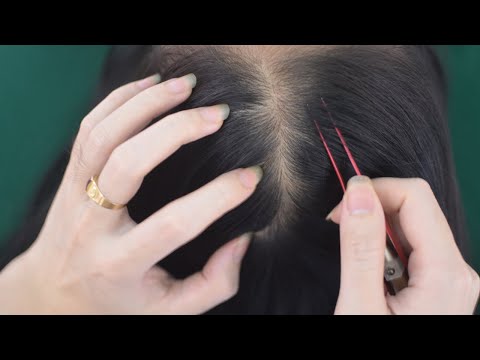 ASMR Hair Sounds With Scalp Scratch, No Talking Head Massage, Relaxing For Headache Reduce