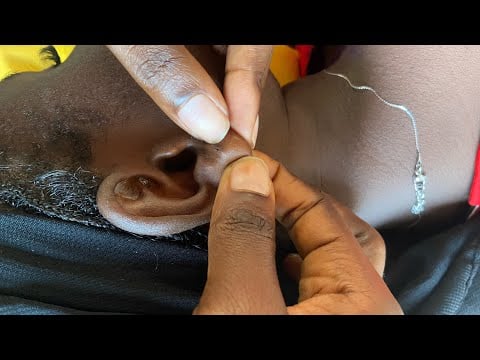 ASMR SUPER ATTENTIVE EAR PICKING AND CLEANING FOR SLEEP WITH GUM CHEWING