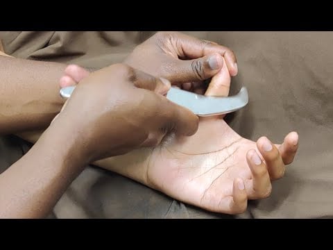 IASTM/Gua Sha/Scraping the hands and fingers