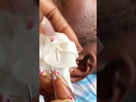ASMR EAR CLEANING AND NITPICKING FOR SLEEP #asmr #tingling #relax #satisfying