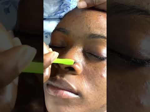 Asmr face nitpicking for sleep #asmrbygracejohn