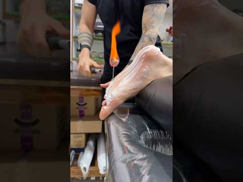 wow cupping #shorts #youtubeshorts #cupping #explore