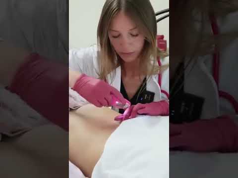 ASMR, Regularly inspecting your belly button is important for hygiene and health. #satisfying