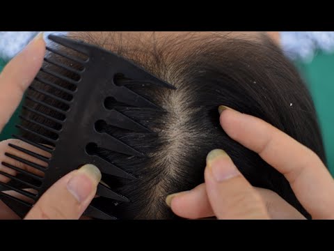 ASMR Dandruff Scratching / Dandruff Cleansing / Dandruff Removal For Relaxation