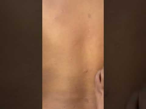 ASMR BACK SCRATCHING AND NITPICKING VERY RELAXING #asmr #asmrsounds #earpicking #backscratching