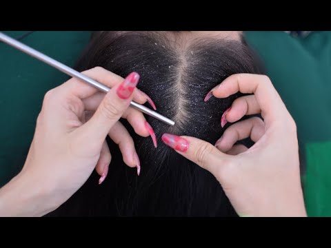 ASMR Relaxing Scalp Check With Sticks, Scalp Scratching For Deep Sleep ( No Talking )