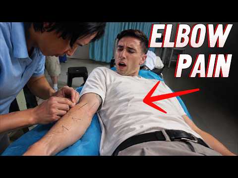 He Put NEEDLES Into My Arm to Fix the Pain…
