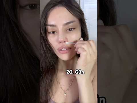 Ameliyat sonrası sürecin de özverili ve sağlıklı olması çok önemli 🙏🏻 reklam yok