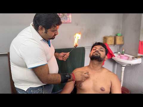 ASMR Barber Shamboo - Relaxing Head & Back Massage With 🔥 Cupping For Stress & Pain Relief Therapy