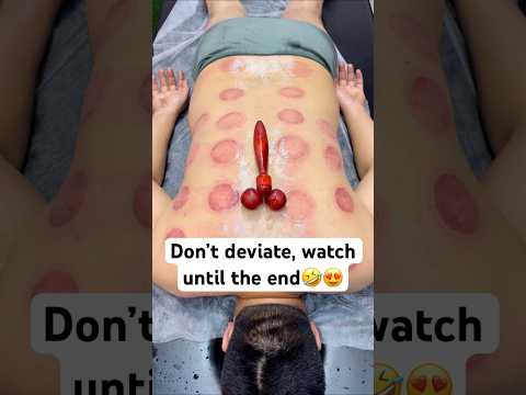 😍🤣🤣#shorts #shorshorts #cupping #fire #massage