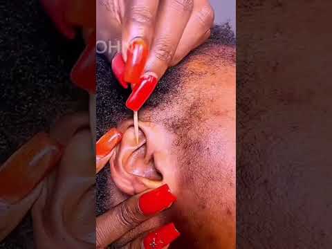 Asmr ear cleaning and nitpicking #asmr #relax #asmrsounds #earcleaningasmr
