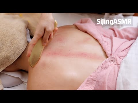 ASMR😪Chinese Gua Sha Massage💆🏻‍♀️Head, Neck & Back Therapy for Stress Relief & Better Sleep